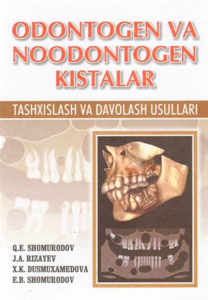 Odontogen va noodontogen kistalar. Tashxislash va davolash usullari 