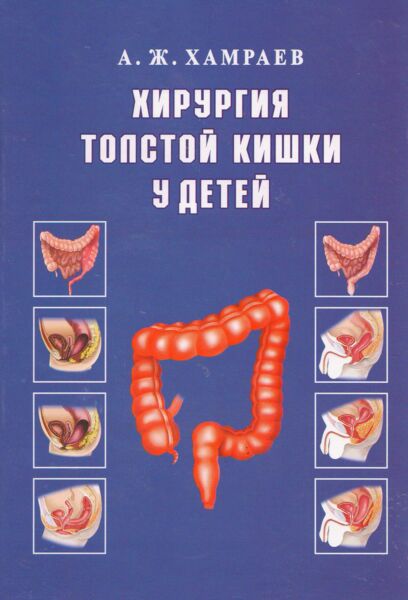 Хирургия толстой кишки у детей