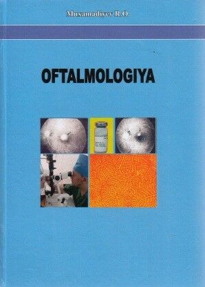 Oftalmologiya