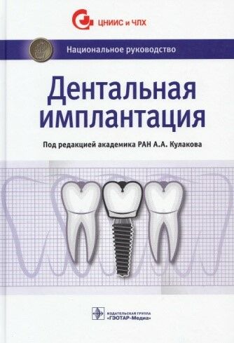 Дентальная имплантация