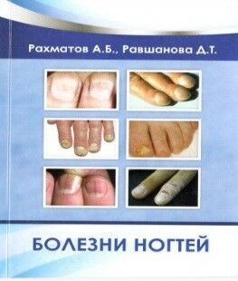 Болезни ногтей 