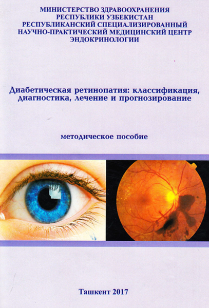 Диабетиче ская ретиноьтия   классификация, диагностика, лечение и прогнозирование