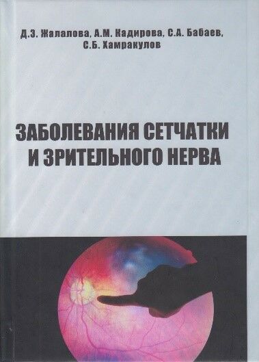 Заболевания сетчатки и эрительного нерва 