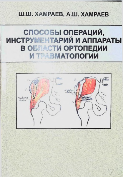 Cпособы операций инструментарий и аппараты в области ортопедии и травматологии