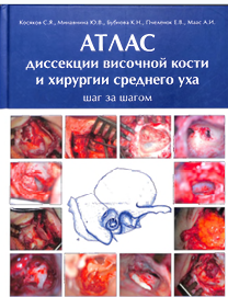 Атлас Диссекции височной кости и хирургии среднего уха