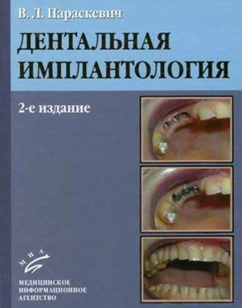 Дентальная имплантология