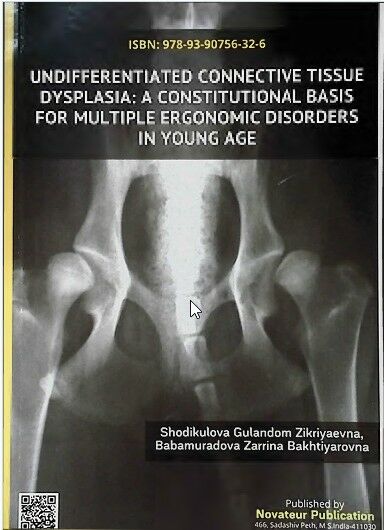 Undifferentiated connective tissue dysplasia; A constitutional basis for multiple ergonomic disorders in young age