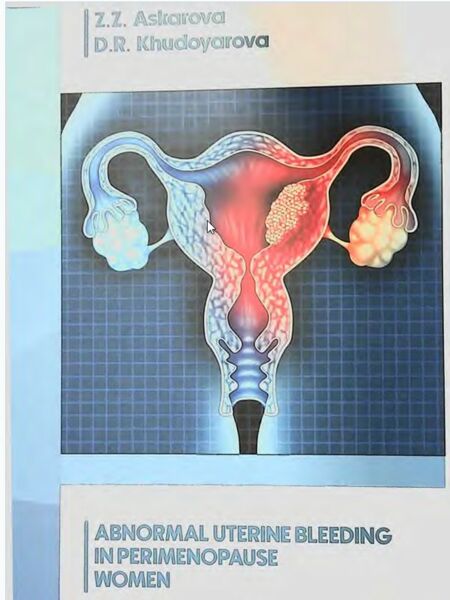 Аbnormal uterine bleeding in perimenopause  women