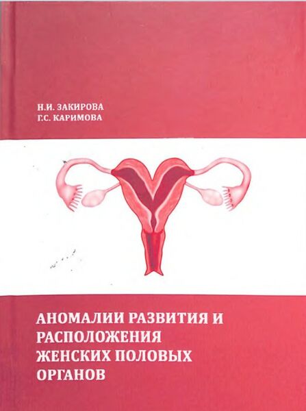 Аномалии развития и расположения женских половых органов