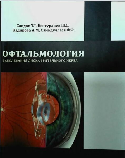Офтальмология Заболевания диска зрительного нерва