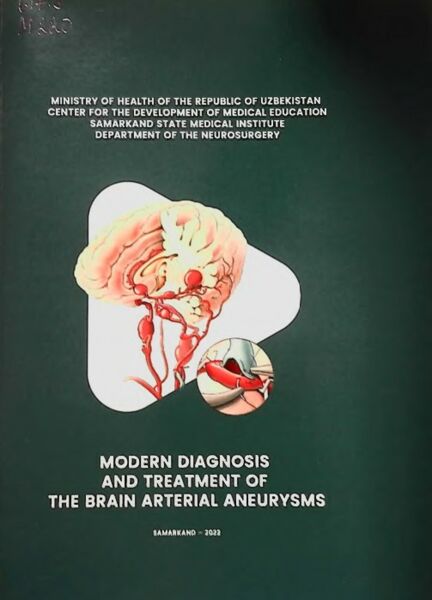 Modern diagnosis and treatment of the brain arterial aneurysms