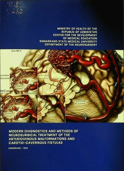 Modern diagnostics and methods of neurosurgical treatment of the arteriovenous malformations and carotid-cavernous fistulas