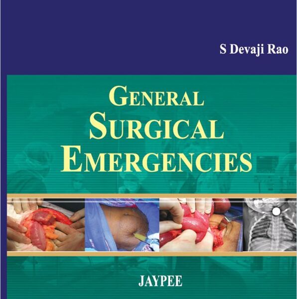 General Surgical Emergencies