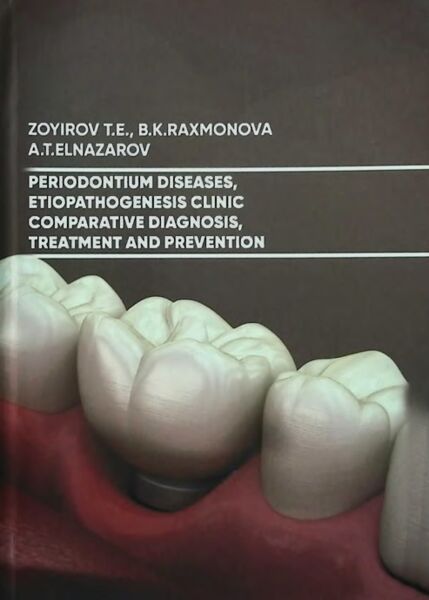 Periodontium diseases, etiopathogenesis clinic comparative diagnosis, treatment and prevention