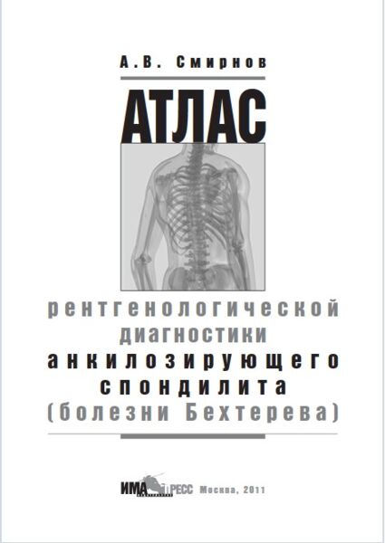 Атлас рентгенологической диагностики анкилозирующего спондилита (болезни Бехтерева)