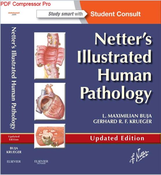 Netter's Illustrated Human Pathology