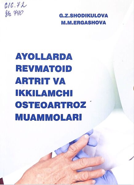 Ayollarda revmatoid artrit va ikkilamchi osteoartroz muammolari
