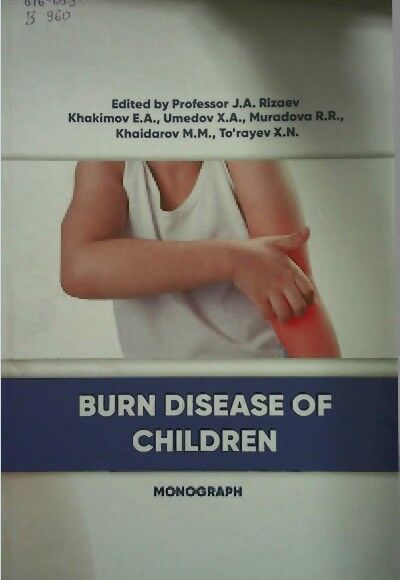 Bum disease o f children