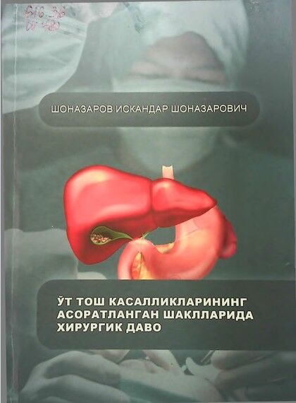 Ут тош касалликларининг асоратланган шаклларида хирургик даво
