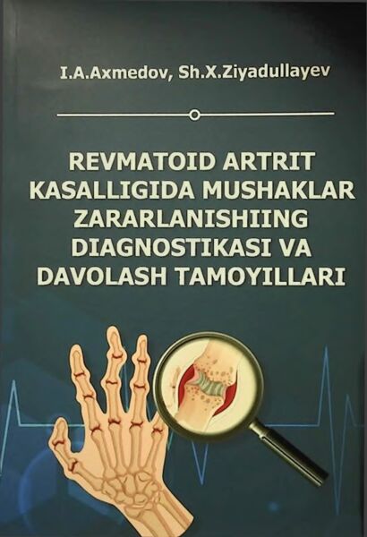 Revmatoid artrit kasalligida mushaklar zararlanishiing diagnostikasi va davolash tamoyillari
