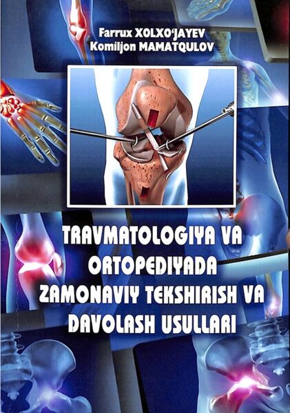 Travmatologiya va ortopediyada zamonaviy tekshirish va davolash usullari.