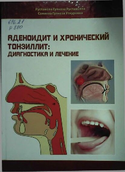 Аденоидит и хронический тонзиллит: диагностика и лечение