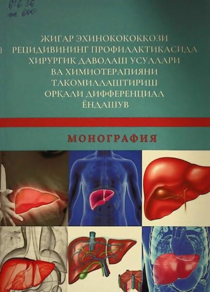 Жигар эхинокококкози рецидивининг профилактикасида хирургик даволаш усуллари ва химиотерапияни такомиллапггириш орқали дифференциал ёндашув