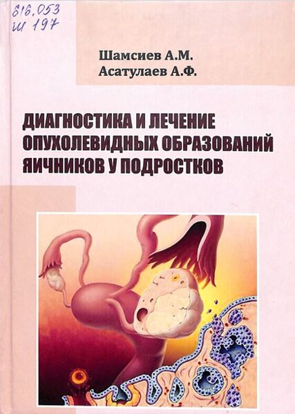 Диагностика и лечение опухолевидных образований яичников у подростков