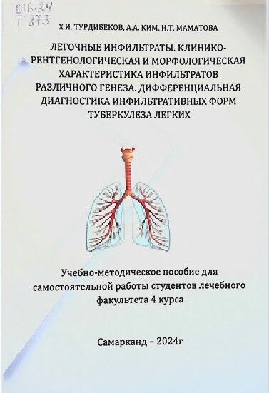 Легочные инфильтраты. Клинико¬ рентгенологическая и морфологическая  характеристика инфильтратов  различного генеза. Дифференциальная  диагностика инфильтративных форм  туберкулеза легких