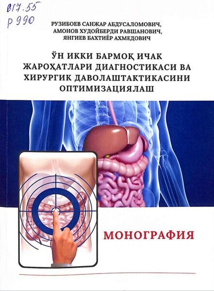 Ун икки бармоқ ичак жарохдтлари диагностикаси ва хирургии даволаш тактикасини оптимизациялаш