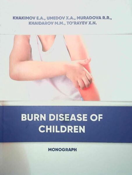 Burn disease of children