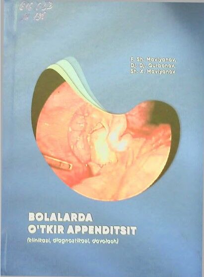 Bolalarda o'tkir appenditsit