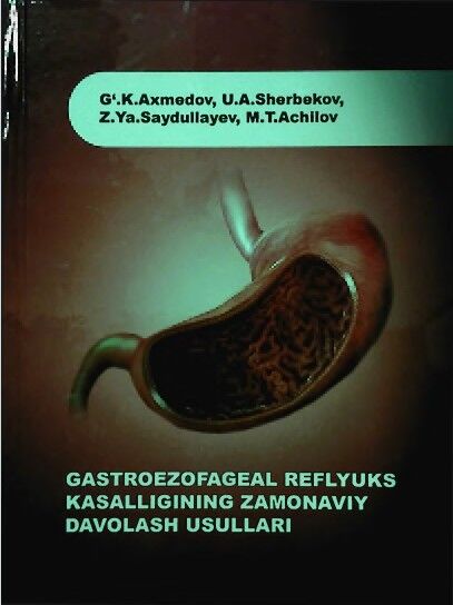 Gastroezofageal reflyuks kasalligining zamonaviy davolash usullari
