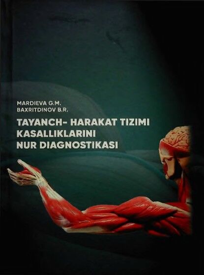 Tavanch-harakat tizimi kasalliklarini nur diagnostikasi