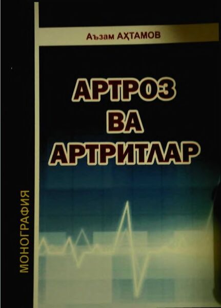 Артроз ва артрнтлар