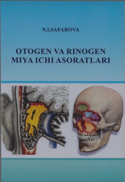 Otogen va rinogen miya ichi asoratlari