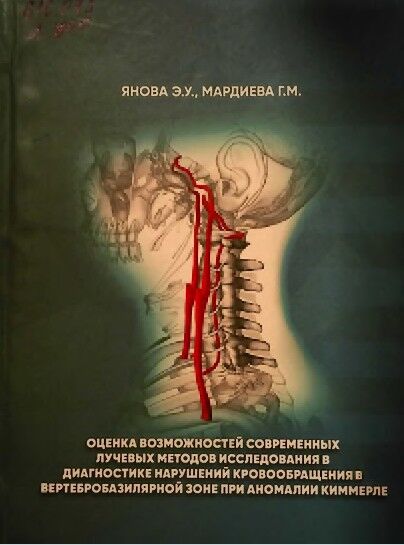 Оценка возможностей современных лучевых методов исследования в диагностике нарушений кровообращения в вертебробазилярной зоне при аномалии киммерле