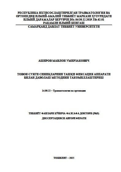 Товон суяги синиқларини ташқи фиксация аппарати  билан даволаш методини такомиллаштириш