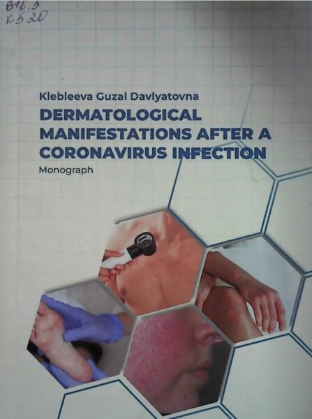 Dermatological manifestations after a coronavirus infection