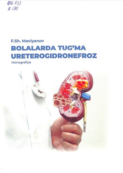 Bolalarda tug’ma ureterogidronefroz