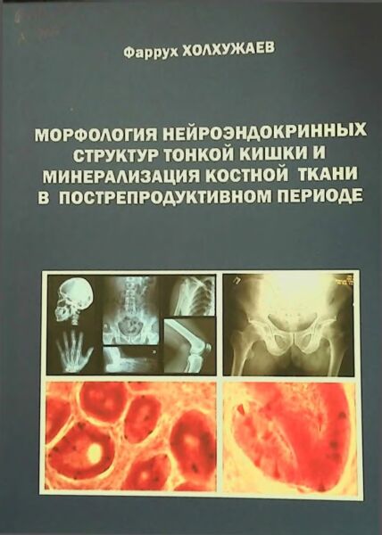 Морфология нейроэндокринных структур  тонкой кишки и минерализация костной  ткани в пострепродуктивном периоде