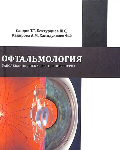 Заболевания диска зрительного нерва