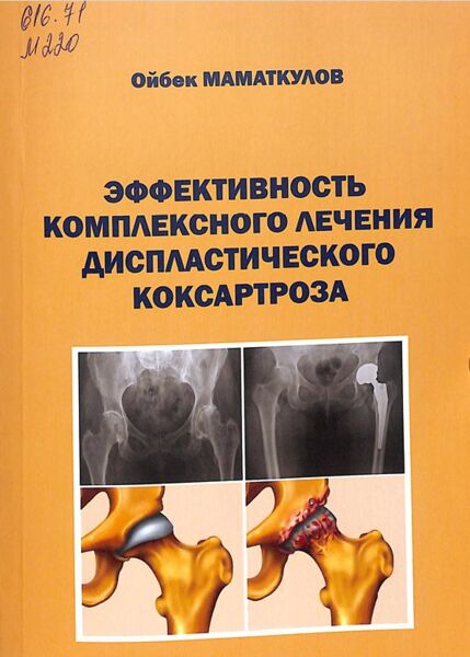 Эффективность комплексного лечения диспластического коксартроза