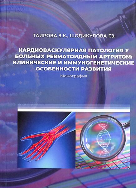 Кардиоваскулярная патология у больных ревматоидным артритом: клинические и иммуногенетическис особенности развития