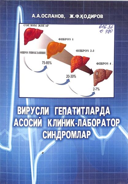 Вирусли гепатитларда асосий клиник-лаборатор синдромлар