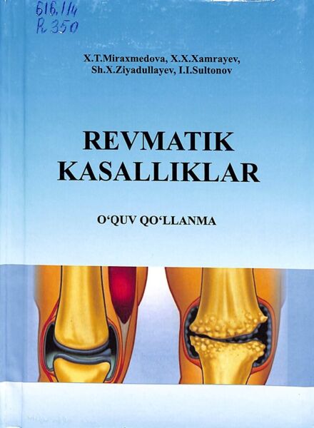 Revmatik kasalliklar
