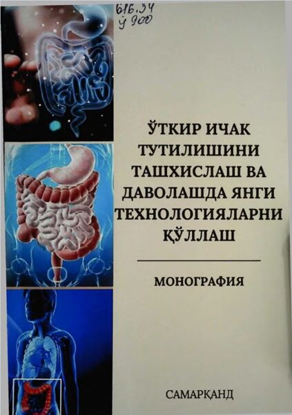 Уткир ичак тутилишини ташхислаш ва даволашда янги технологияларни қуллаш