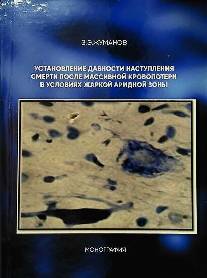 Установление давности наступления смерти после массивной кровопо­тери в условиях жаркой аридной зоны