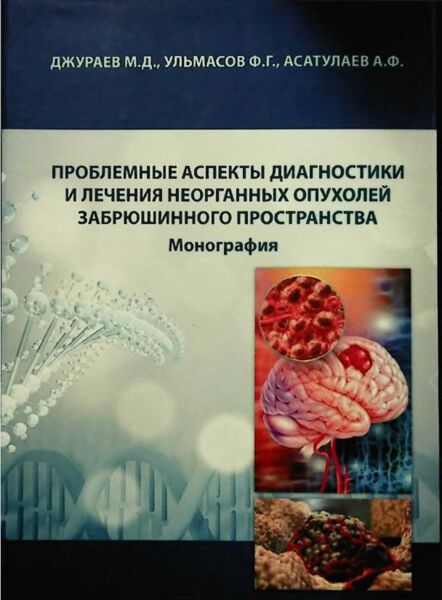 Проблемные аспекты диагностики и лечения неорганных опухолей забрюшинного пространства