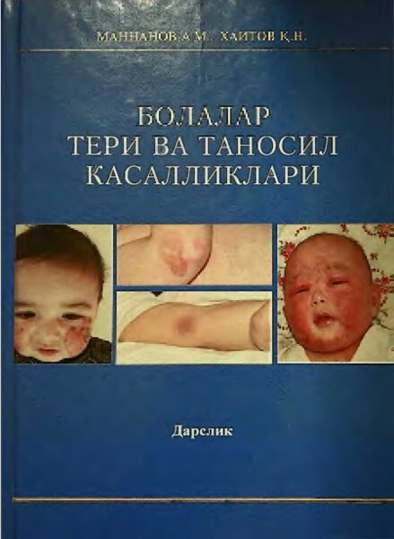 Болалар тери ва таносил касалликлари